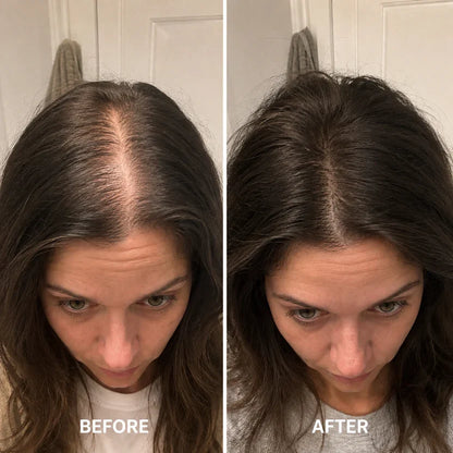 Desoxyribose Scalp Serum