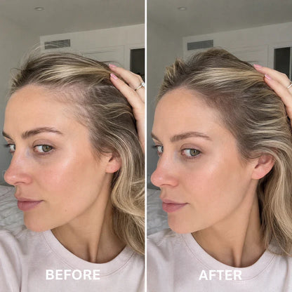 Desoxyribose Scalp Serum