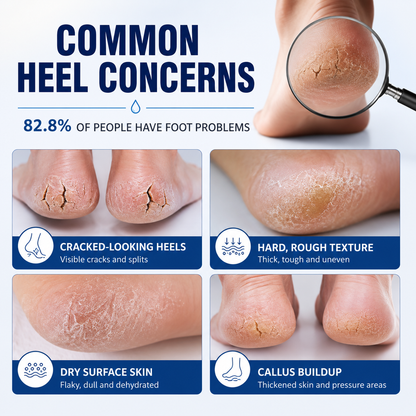MEDAZY™ Heel Recovery System – Cracked Heel Cream + Moisture-Lock Silicone Socks