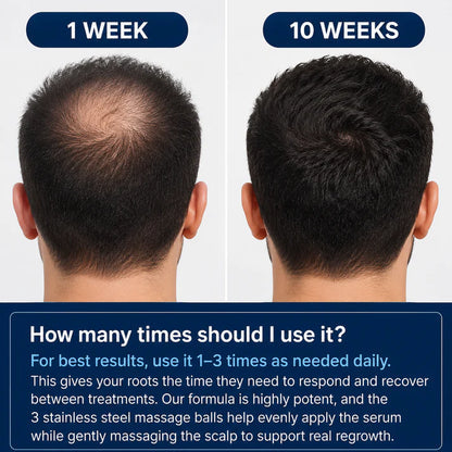 Desoxyribose Scalp Serum