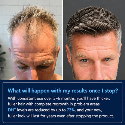 Desoxyribose Scalp Serum